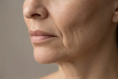 طرق التعامل مع نحافة الوجه أثناء الرجيم واستعادة نضارته
